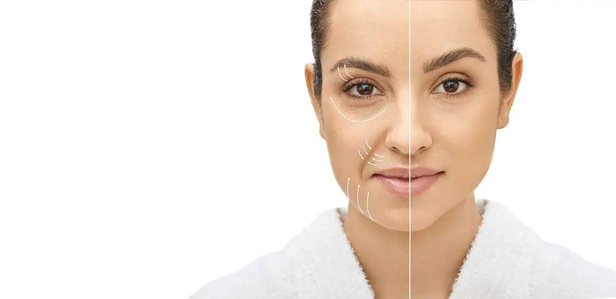 skin tightening-the-skin-refirenry